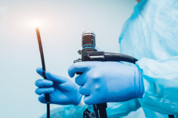 Videoendoscopia da deglutição